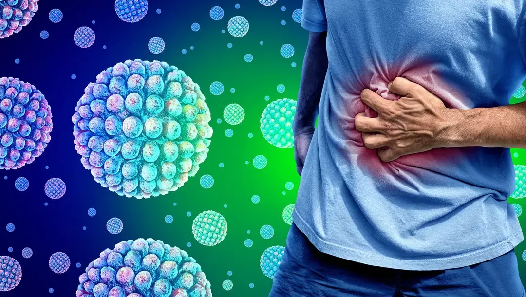 Küresel Sağlık Alarmı: Norovirüs Salgını Yayılıyor